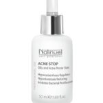 ACNE STOP